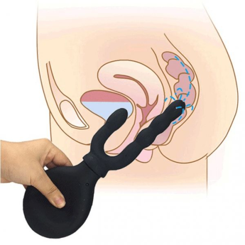 Анальний душ Douche Syringe чорний - 1